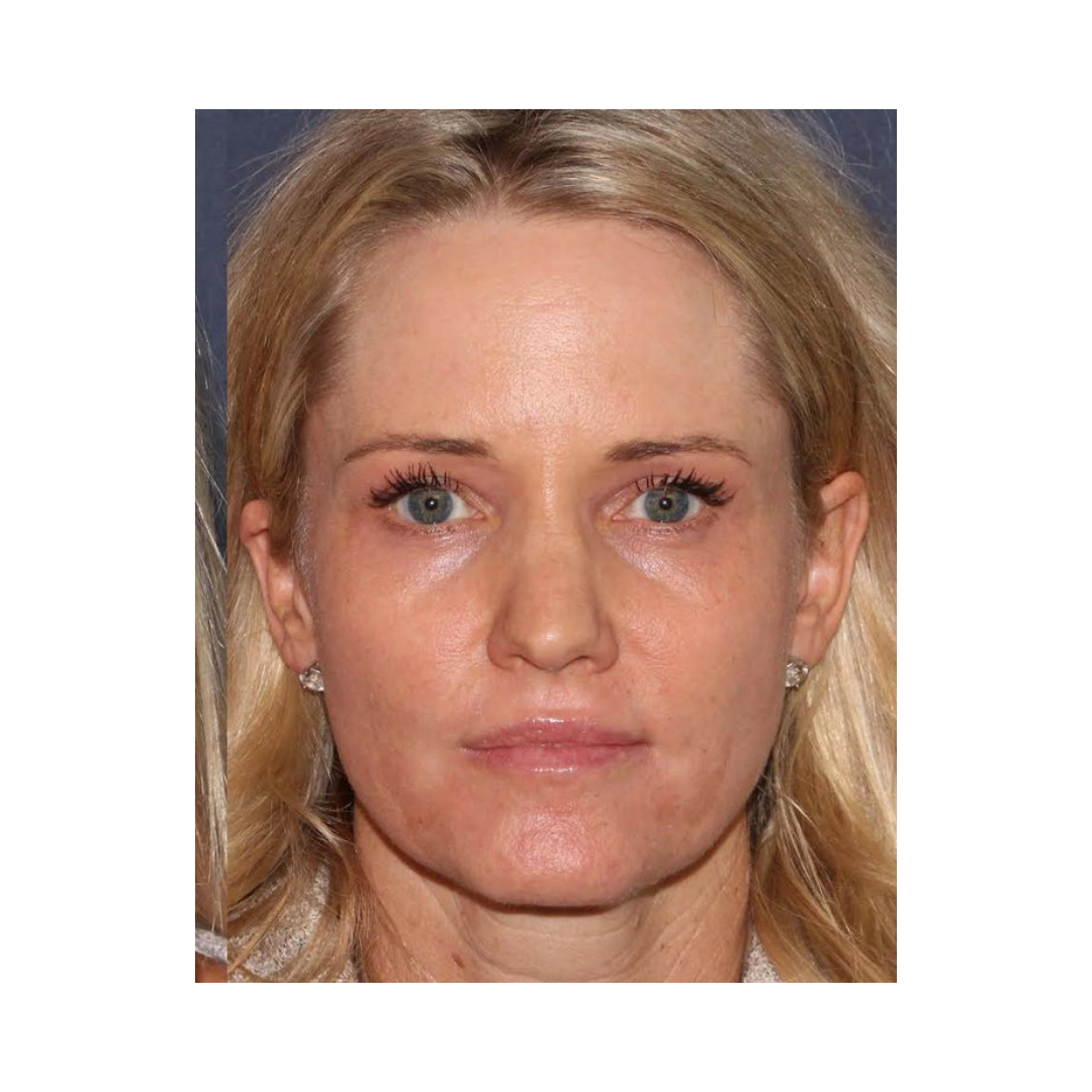 Describes the appearance of the image